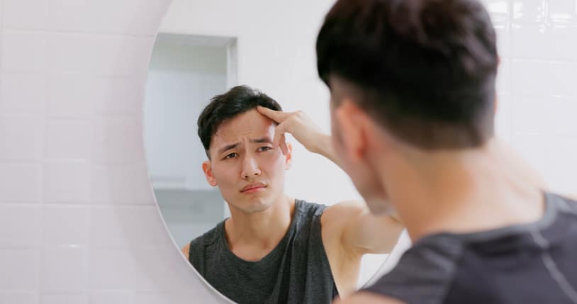 治療前に知っておきたいAGA治療の注意点